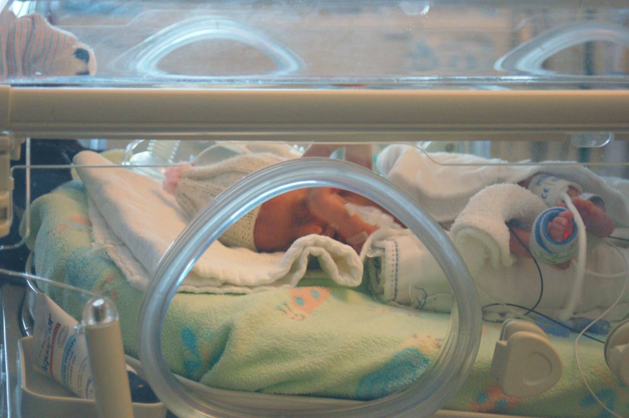 Un modelo matematico estabiliza la temperatura de los bebes en las incubadoras