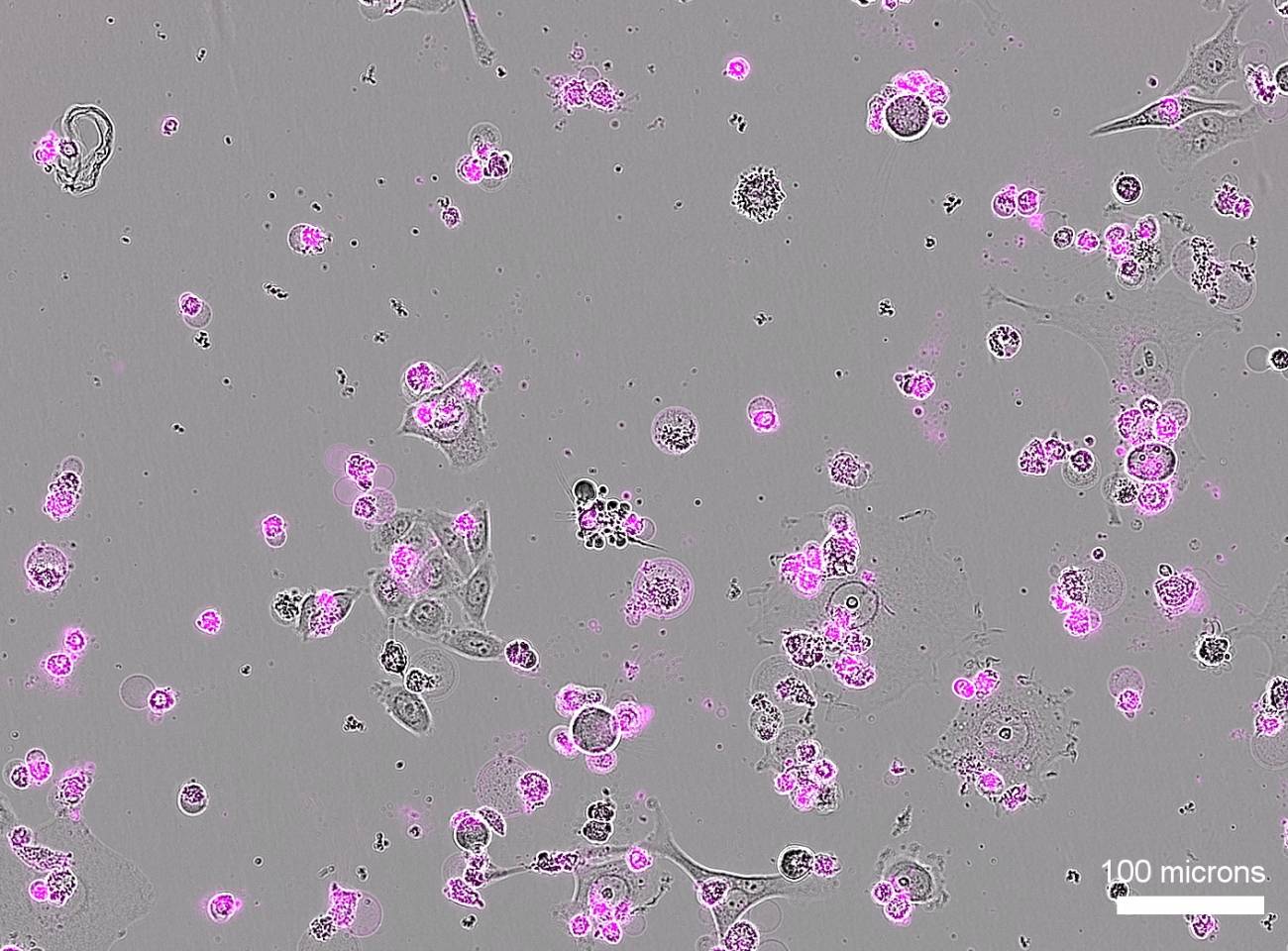 Muerte celular generalizada tras el tratamiento con CRISPR Cas12a2