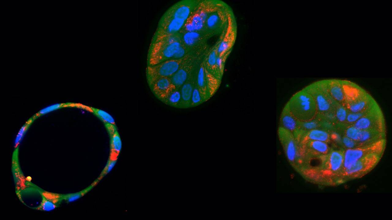 Organoides hepáticos derivados de pacientes y sus mitocondrias
