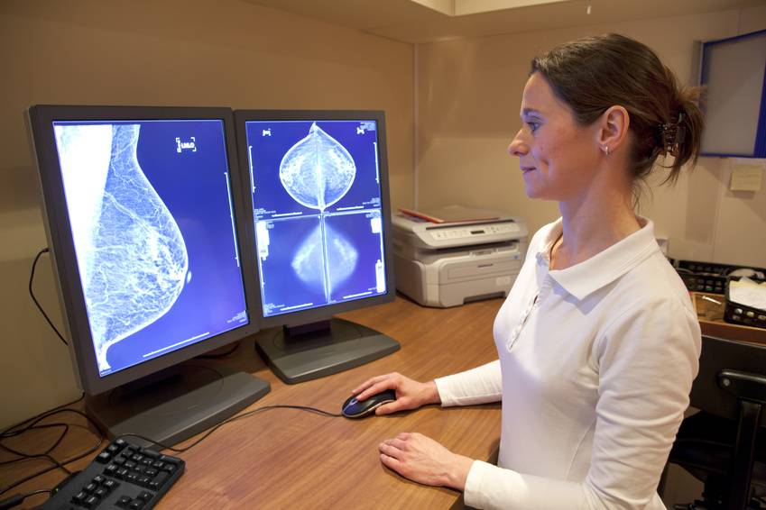 Un nuevo estudio indica que las mamografías reducen la mortalidad por cáncer de mama