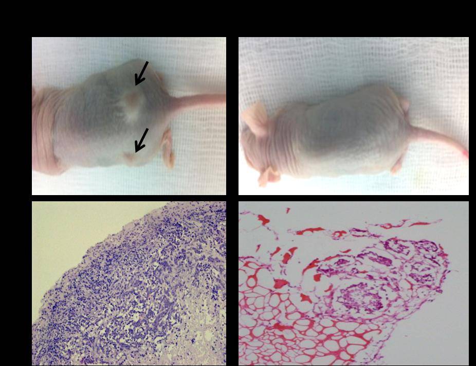 Cortes histológicos de un tumor primario