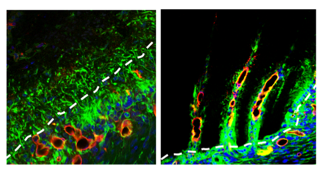 Un nuevo implante ayuda al cerebro a autorregenerarse
