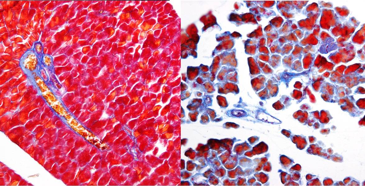 Comparación pancreática, sin y con supresión del gen Wt1