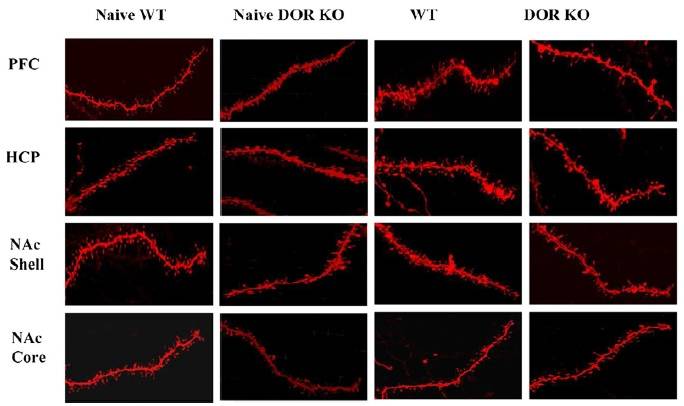 Figura: Cambios neuronales inducidos por el consumo de chocolate en ratones que no expresan el receptor DOR (DOR KO) y ratones normales (wild type). DCEXS-UPF