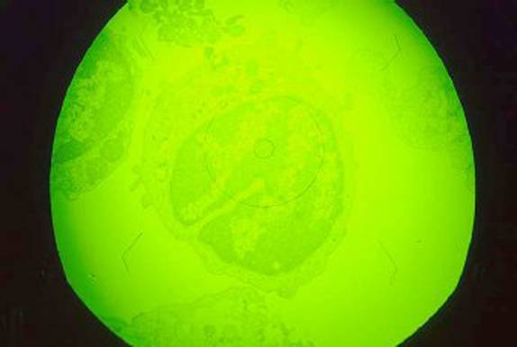Virus de la peste porcina africana. Imagen Wikipedia