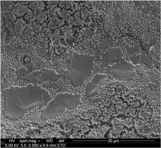 Biocapa de S. epidermidis sobre titanio