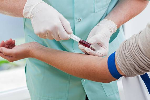 Un simple análisis de sangre para localizar dónde crecen los tumores
