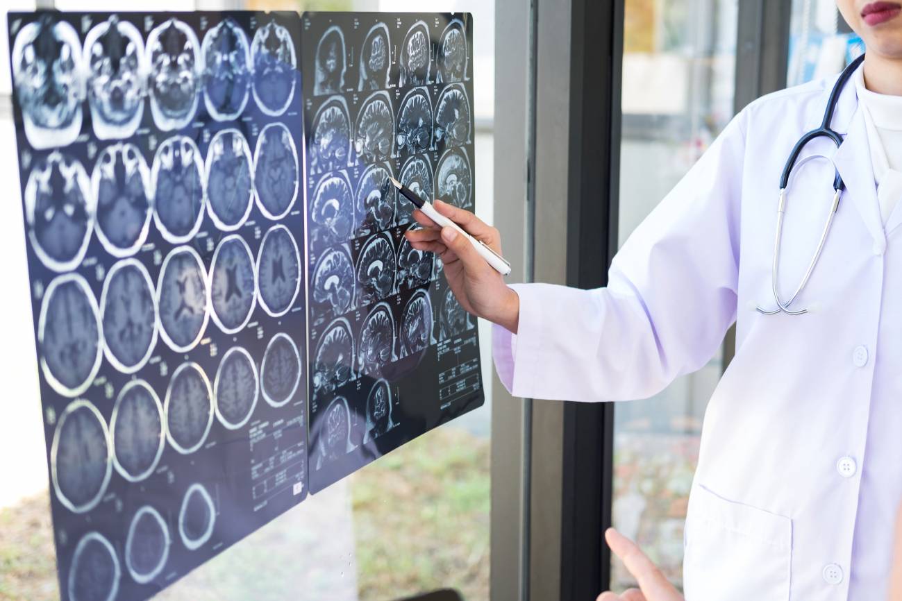 Doctor mira la resonancia magnética del cerebro de un paciente