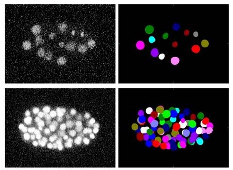 Imágenes de microscopía de un gusano 