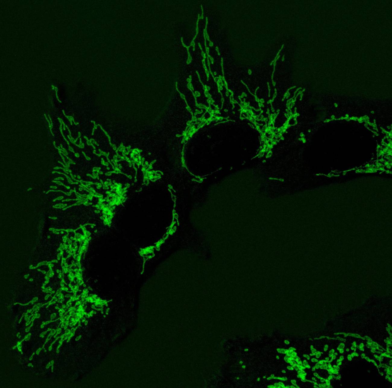 Una enzima de la levadura del pan ayuda a las células humanas a reparar defectos mitocondriales