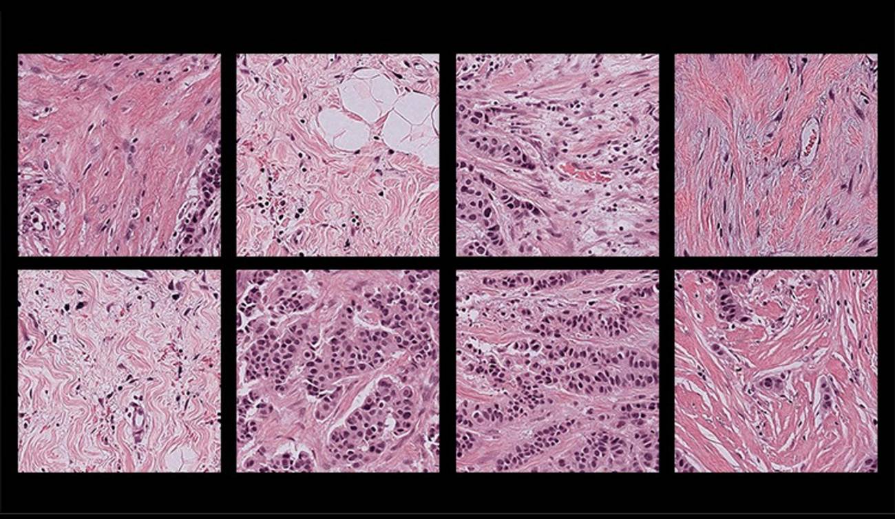 Imágenes patológicas de muestras de tejido humano