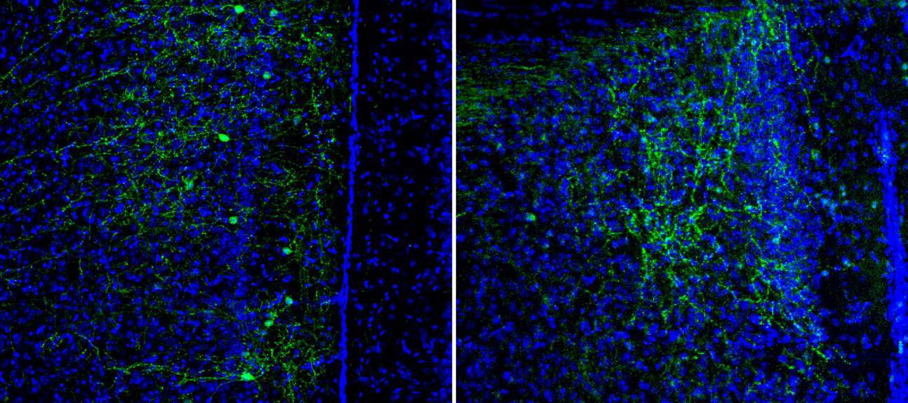 Neuronas CRH+