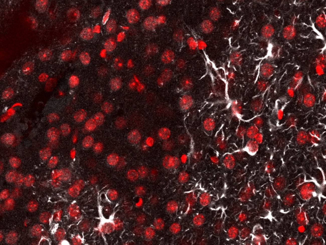 linterna molecular, detección de metástasis