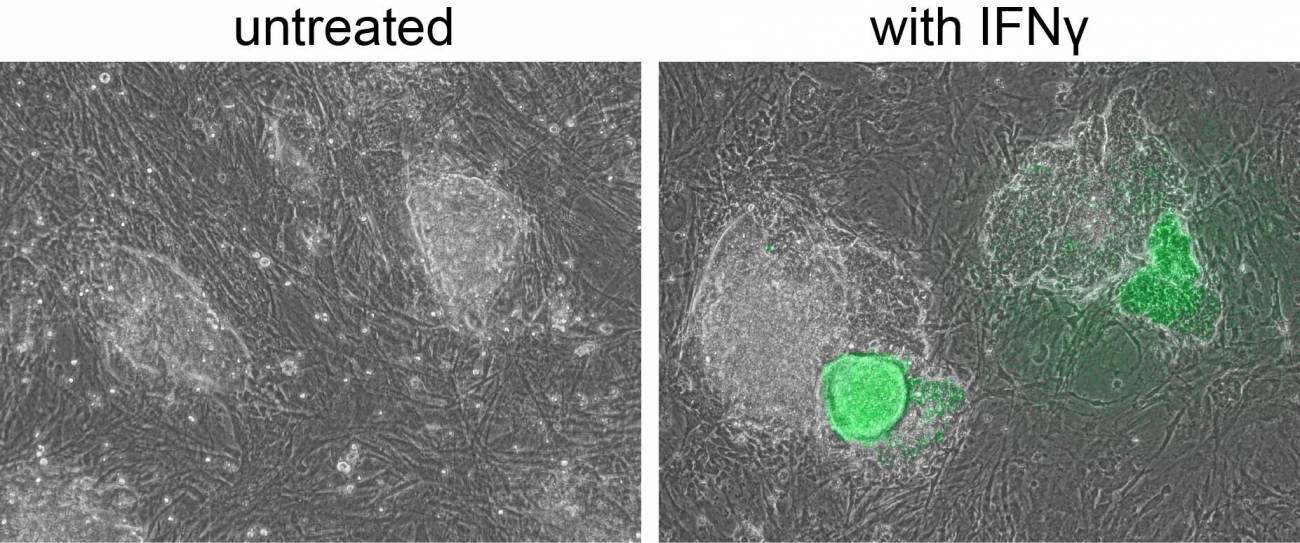 Imágenes de microscopía de células madre