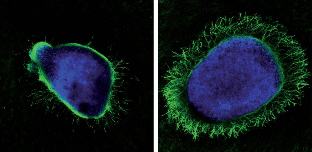 Una proteína generada por el virus del herpes potencia el crecimiento axonal