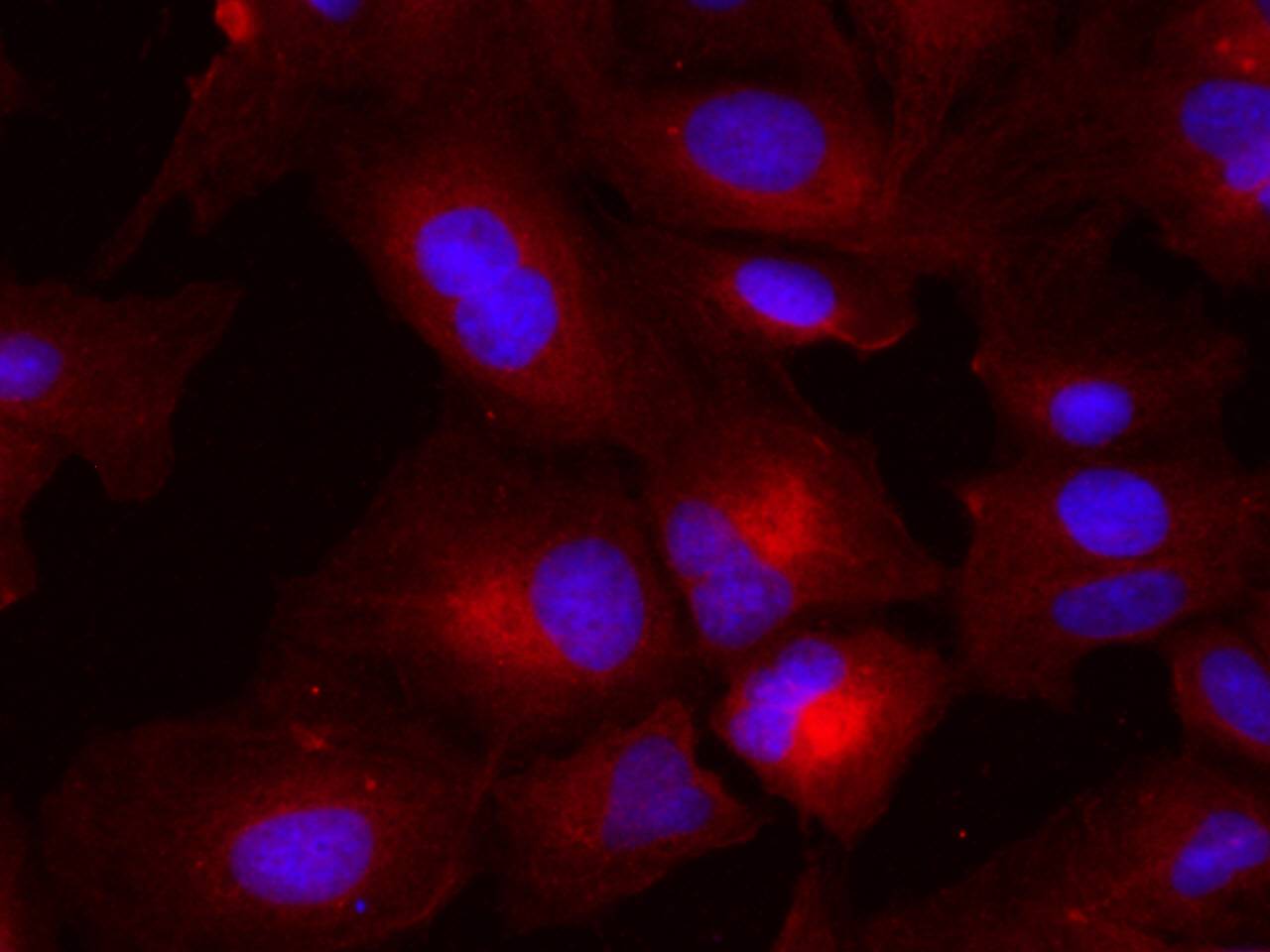 El trabajo, en el que colaboran con la Universidad de Meinz, ha sido publicado en la revista ‘British Journal of Cancer’