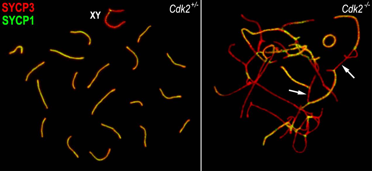 Una proteína puede ser la causa de la imposibilidad de formar espermatozoides