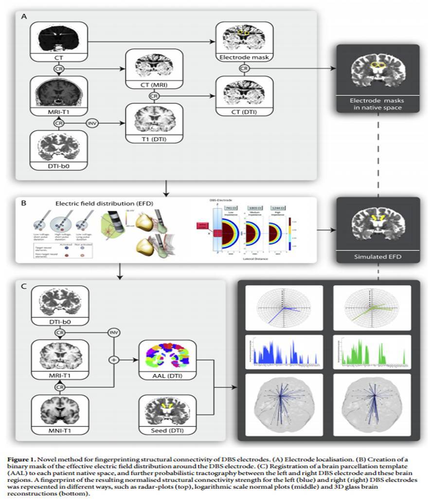 Variaciones en la conectividad cerebral en los trastornos mentales