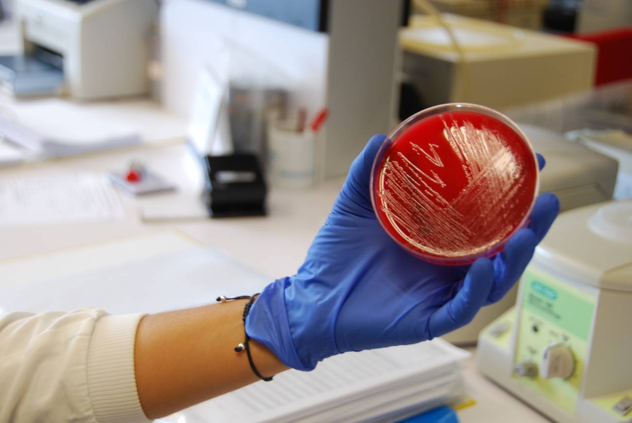 Visitamos los laboratorios que buscan el origen del brote de listeriosis