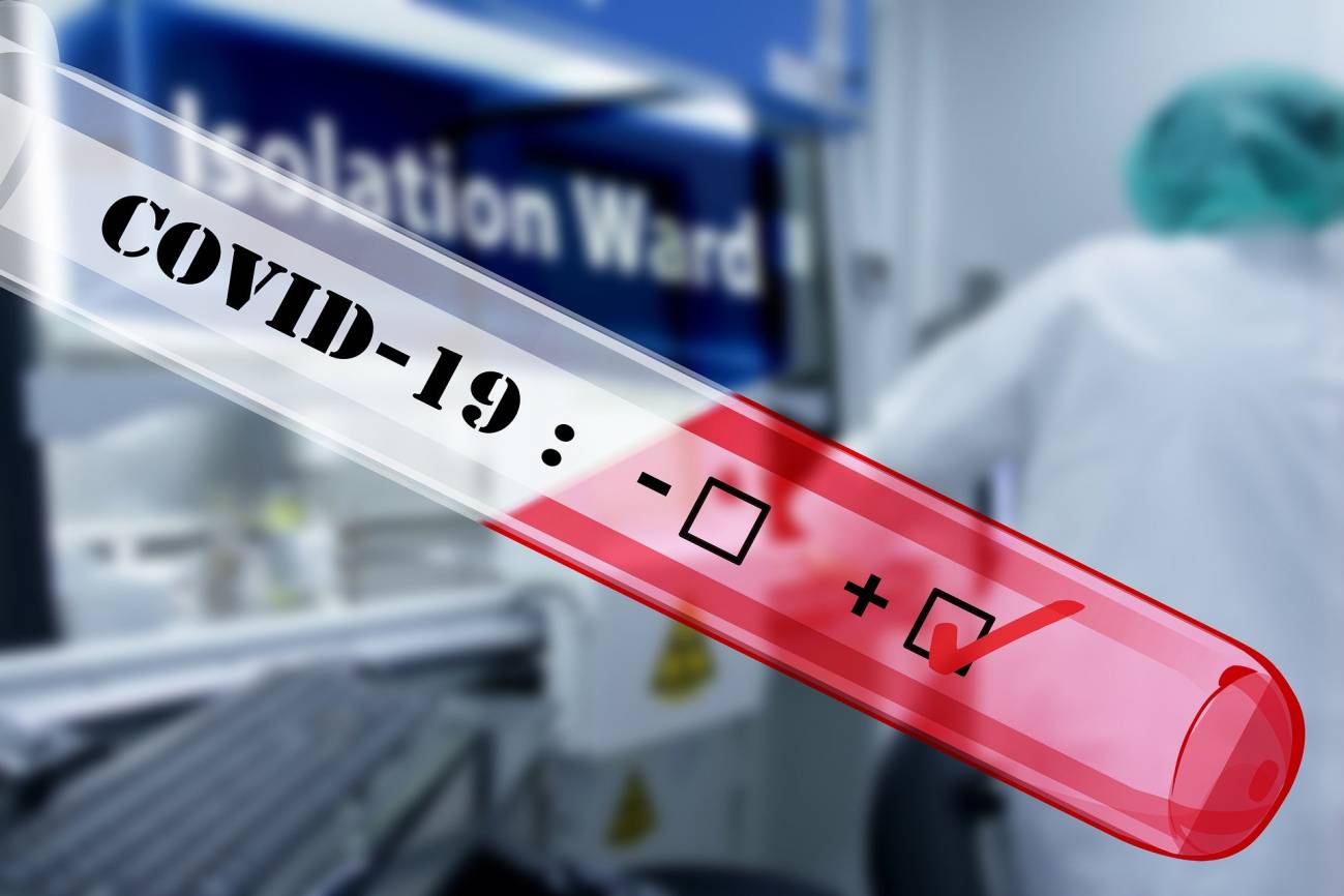 Por qué necesitamos más test para entender la COVID-19