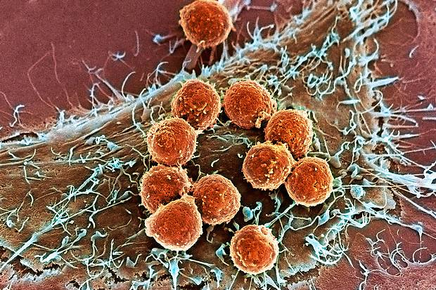 Why immunotherapy for cancer is the scientific breakthrough of the year