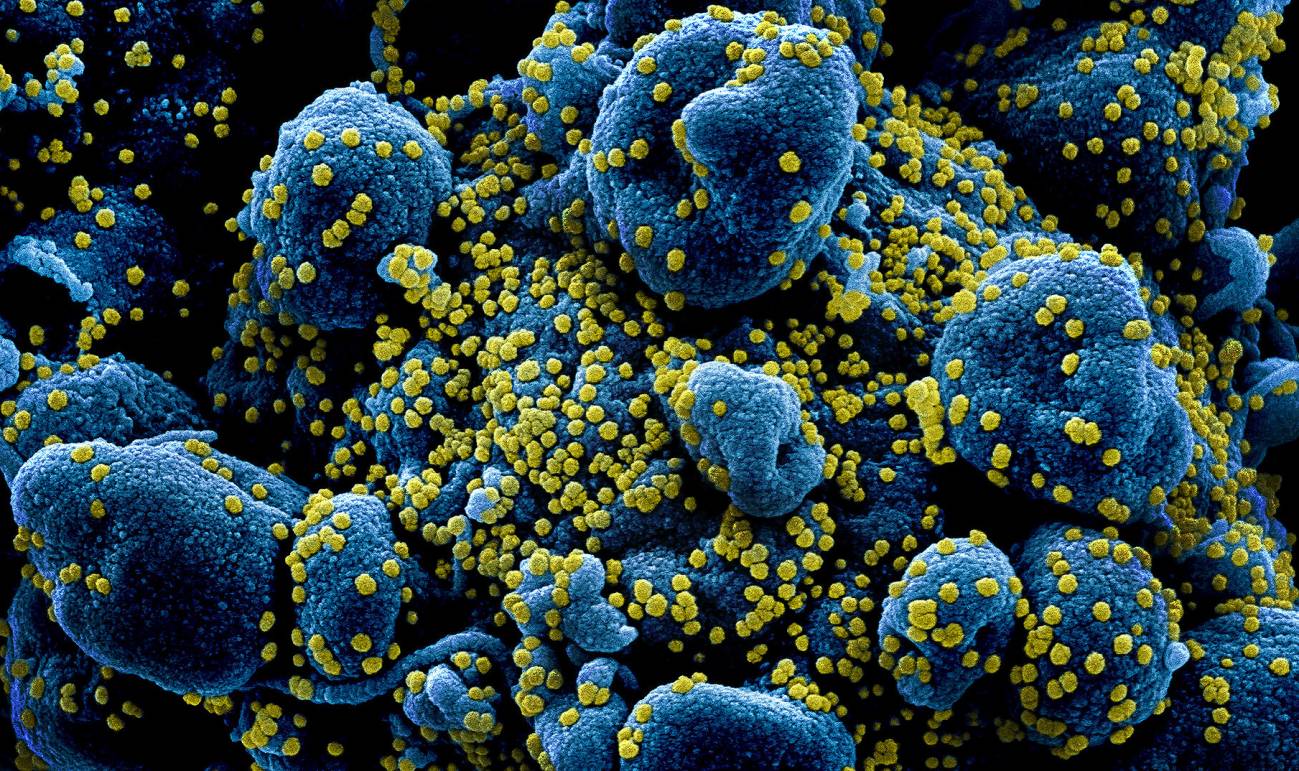¿El coronavirus es un ser vivo?