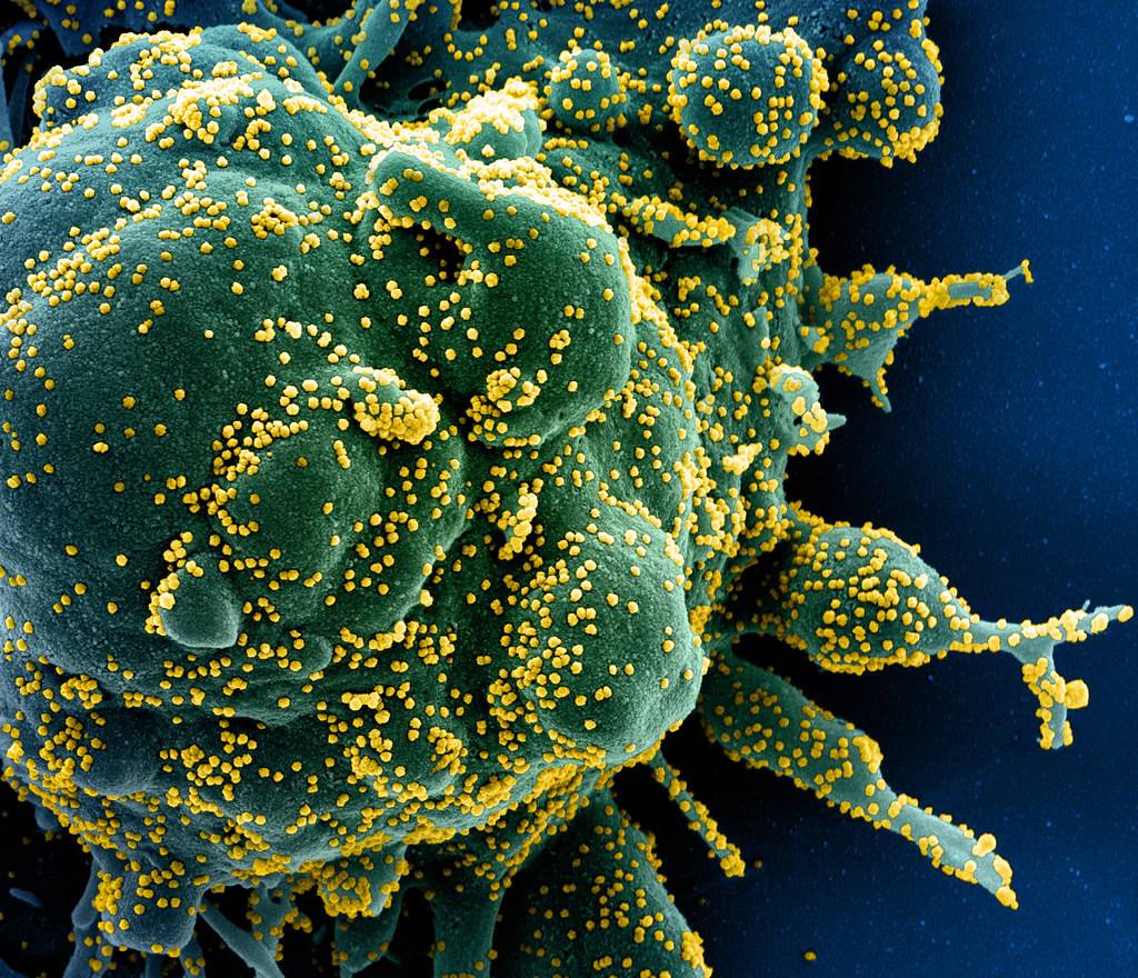  ¿Es hora de investigar si el nuevo coronavirus salió de un laboratorio? 