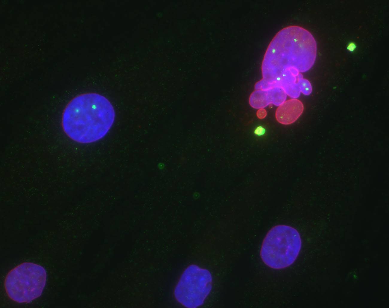 La vejez bajo el microscopio