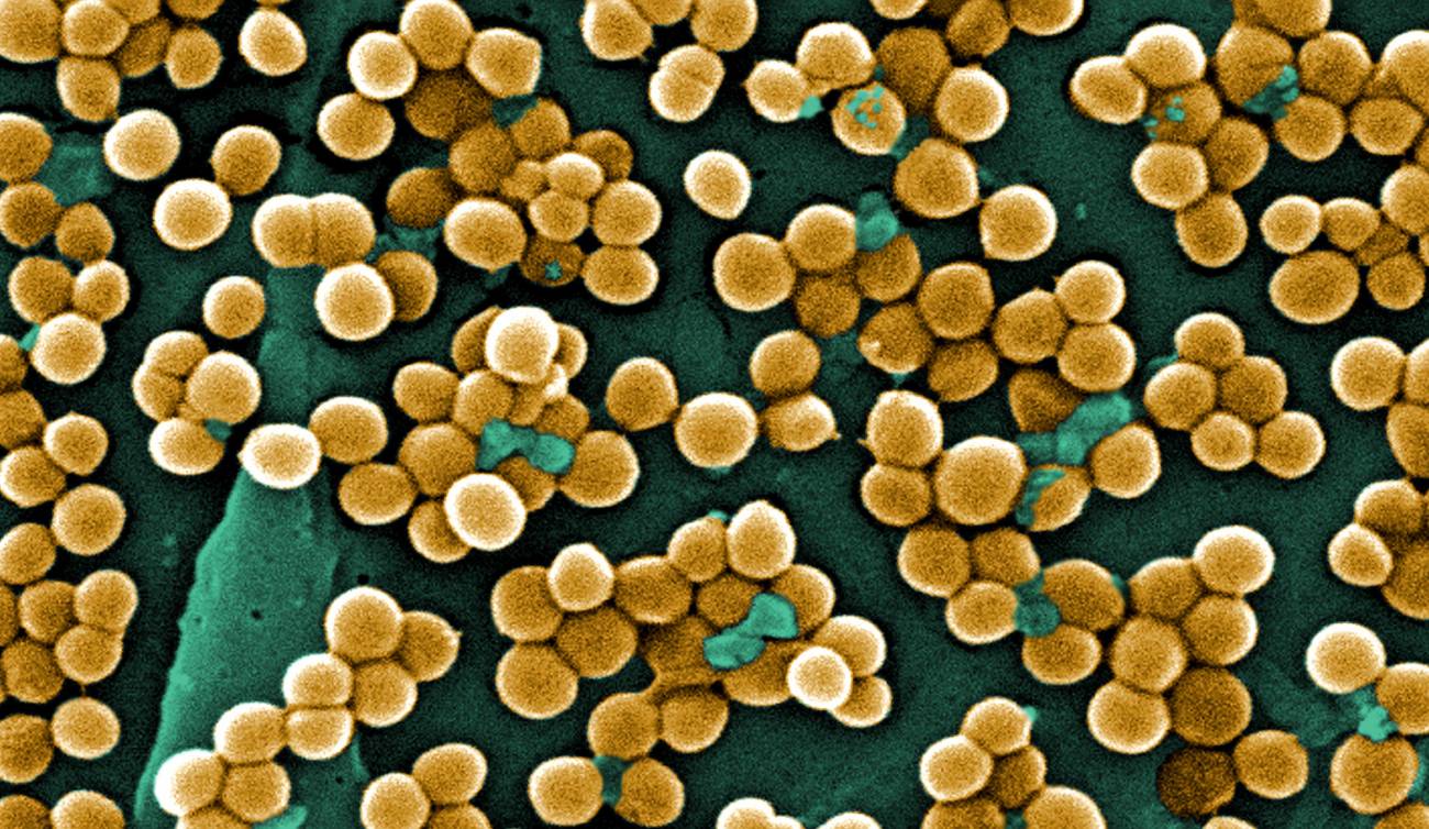 Bacteria ‘Staphylococcus aureus’