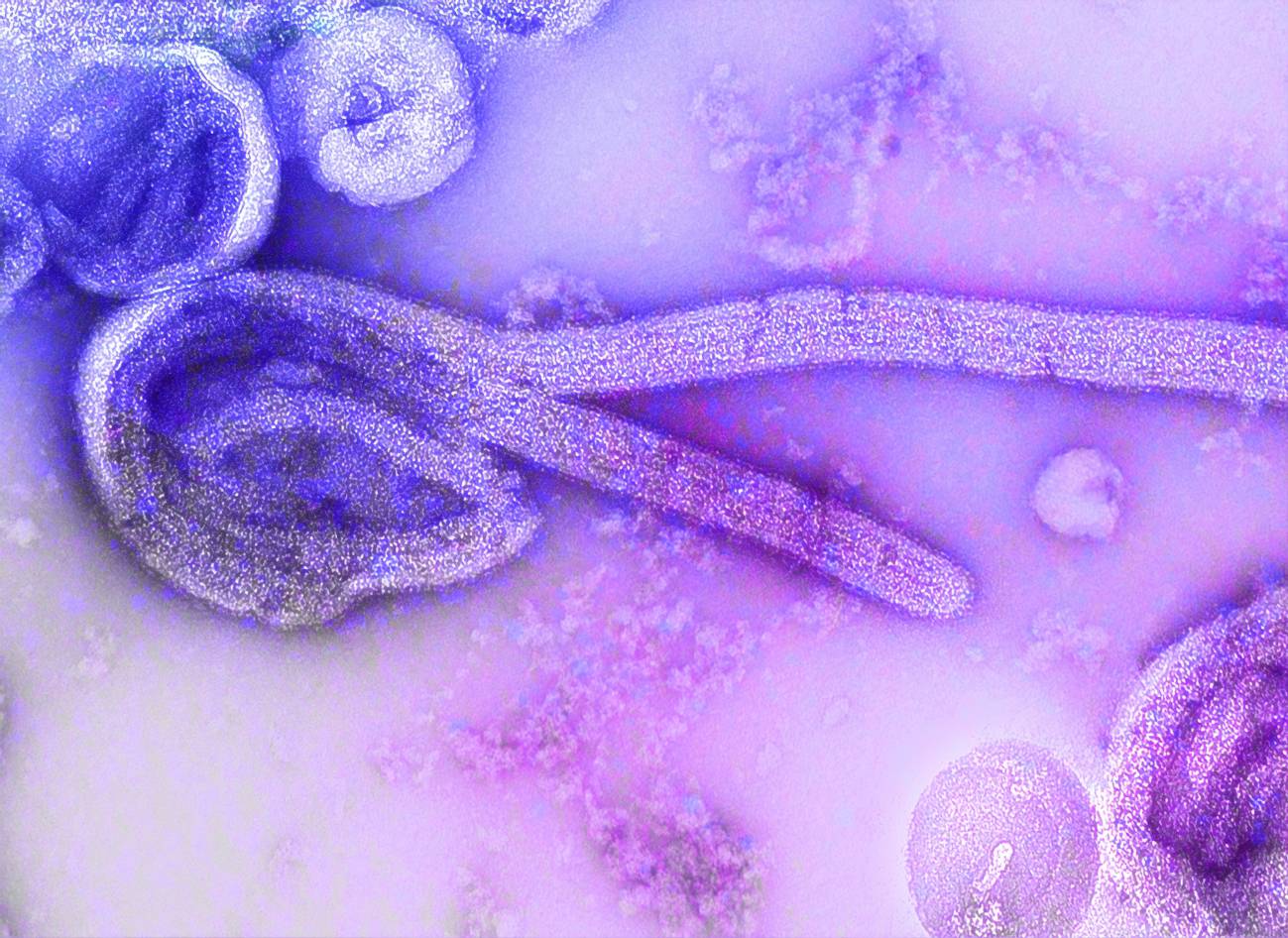 virus del ébola
