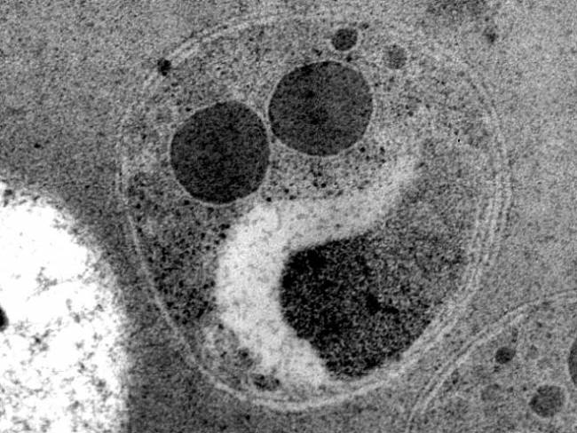 Plasmodium falciparum, el parásito de la malaria, en en su forma de Merozoito.