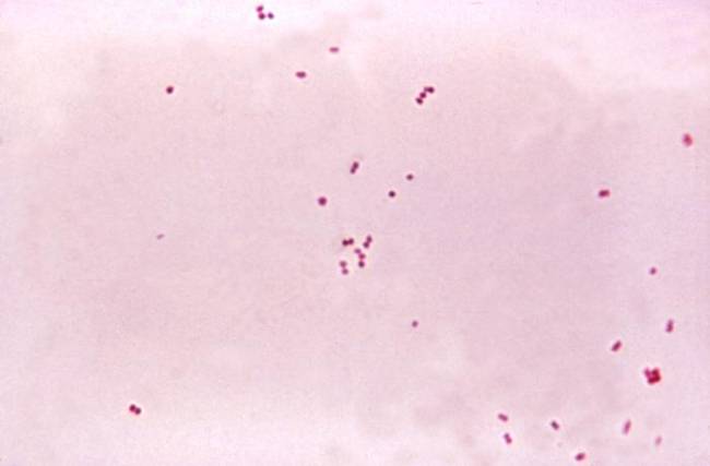 Neisseria meningitidis. Foto: Wikipedia.