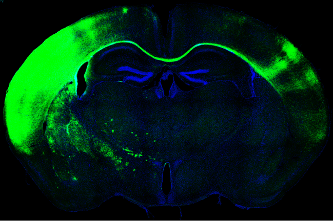 Cerebro de ratón, cuerpo calloso