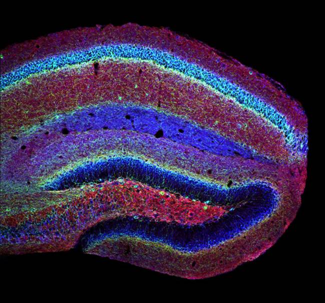  El receptor de cannabinoide CB1, en el hipocampo de un ratón adulto. / Adán de Salas-Quiroga. 