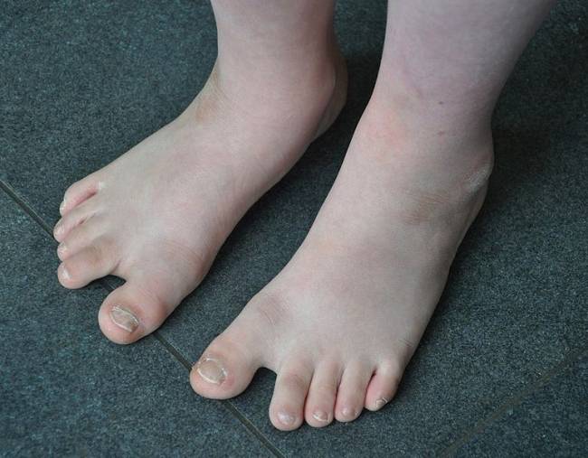 pies
