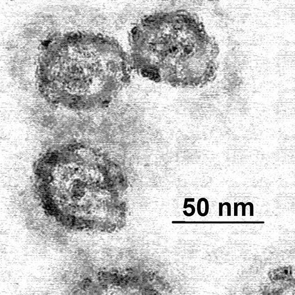 virus de la hepatitis C