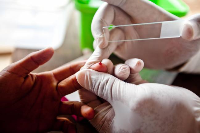 Test para detección de malaria. / Gates Foundation