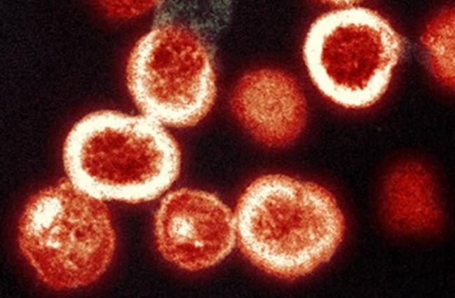 Virus del VIH