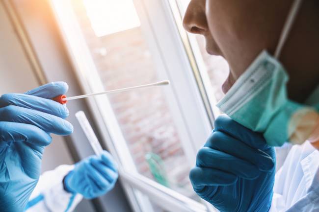 exudado pcr prueba