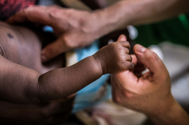 polio en África