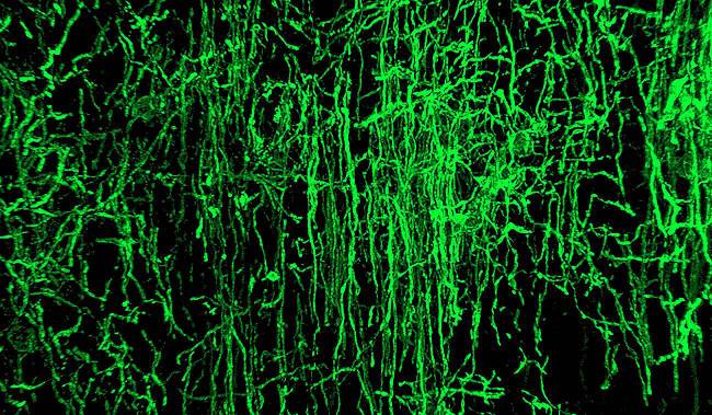 Oligodendrocitos como estos (en verde) se encargan de mielinizar los axones neuronales