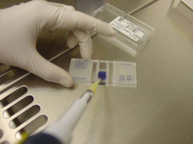 Aplicación de melatonina a células cancerígenas del hígado
