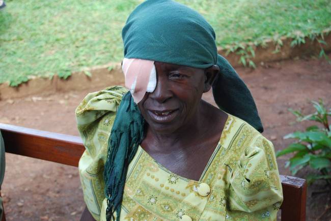 Mujer negra con tracoma. /SINC