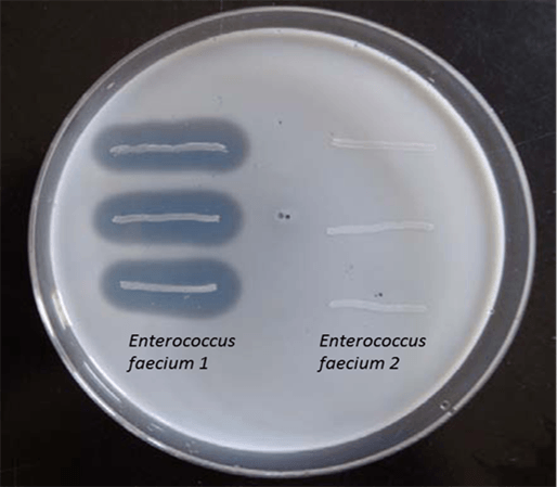 Científicos de León profundizan en esta línea de investigación, que podría ofrecer nuevos tratamientos para la enfermedad celíaca