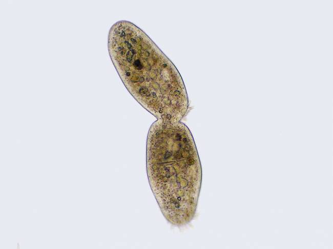 Imagen al microscopio de una ciliophora. / Wikipedia