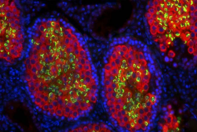 Testículo de quimera ratón-rata al microscopio