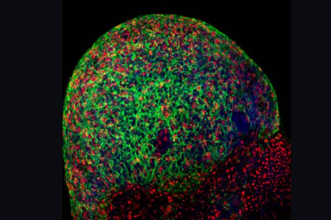 Masa de neuronas derivadas de células madre pluripotentes (iPS) afectadas por el GSS. En verde, los cuerpos celulares y en rojo los núcleos. / IBEC