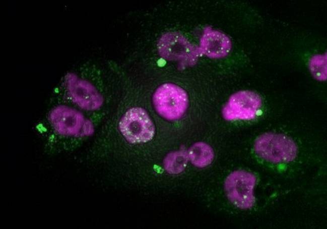 Células tumorales de adenocarcinoma de páncreas que muestran signos de daño en el ADN del núcleo (puntos blancos) y de micronúcleos (en verde), después de un tratamiento con taxol seguido de inhibidores de CDK4/6. /CNIO