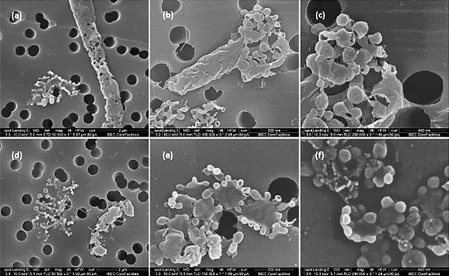 Descomposición de la membrana en una estructura similar a una vesícula en la bacteria Pseudomonas aeruginosa tratada con el antibiótico ciprofloxacina