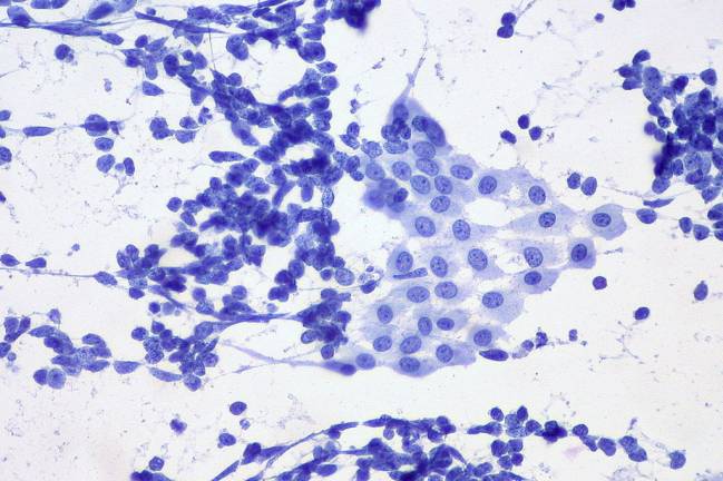 Investigadores del Instituto de Neurociencias de Castilla y León prueban en roedores la eficacia de compuestos químicos que actúan sobre los receptores del neurotransmisor